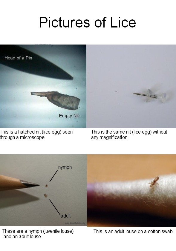 pictures of lice